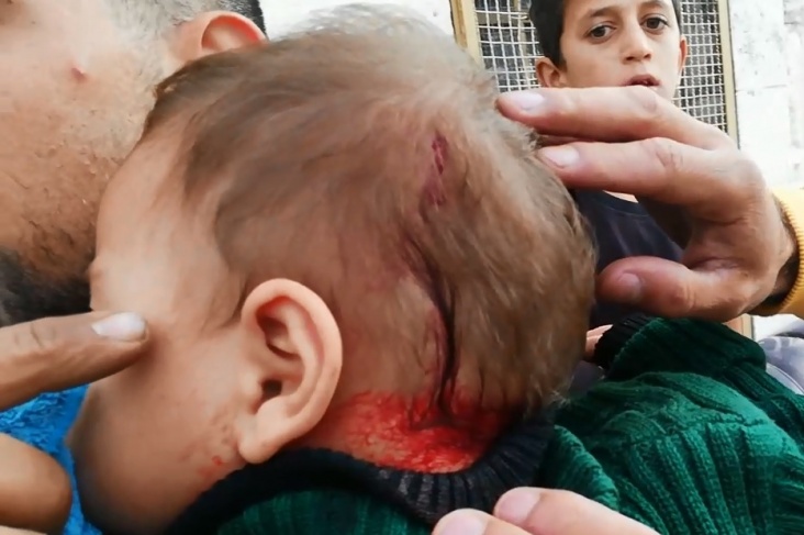 فيديو.. المستوطنون يصعّدون وطفل يصاب بحجر في رأسه