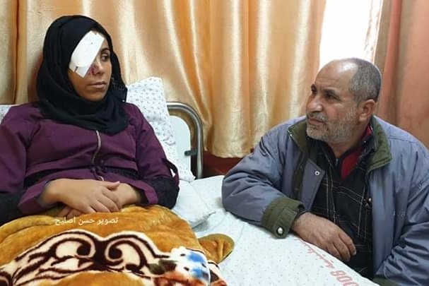 نشطاء يطلقون حملة تضامنية مع المصابة أبو رويضة التي فقدت عينها
